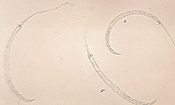 Dracunculus medinensis
